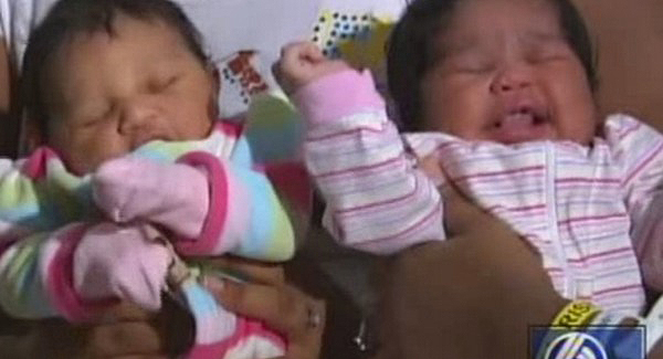 Egy napon szült egy ikerpár egyaránt farfekvéses lányokat